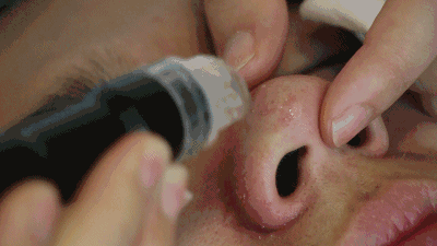 每个女人都希望青春永驻