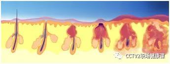 炎炎夏日，教你几招摆脱 “大油脸”！这几个控油雷区千万别踩…