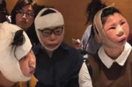 街头发现“猪头脸妹妹”,拆掉绑带以后能吓死人!