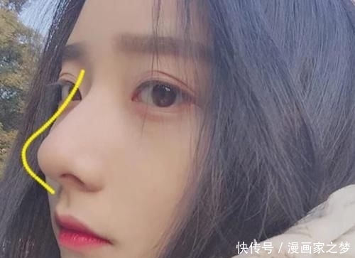 【鸡蛋】鼻子上挤出“白色条状物”?学会这3招,或与“草莓鼻”说拜拜呦!