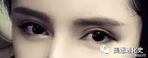 为什么她做了双眼皮却没有变美？