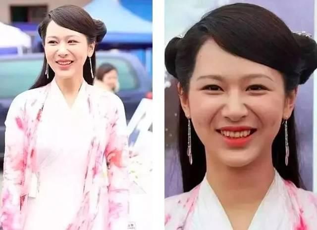 明星也有美中不足的地方，杨紫竟然去除了法令纹，原来全靠这几招