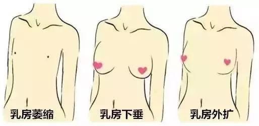 A杯已成稀有存在？日本医美级丰胸霜，帮你一次up3个杯~