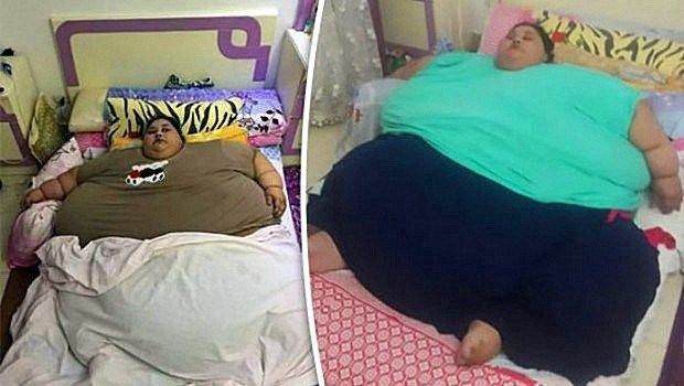 女子体重1000斤，在床上躺25年，去医院需使用吊车和卡车