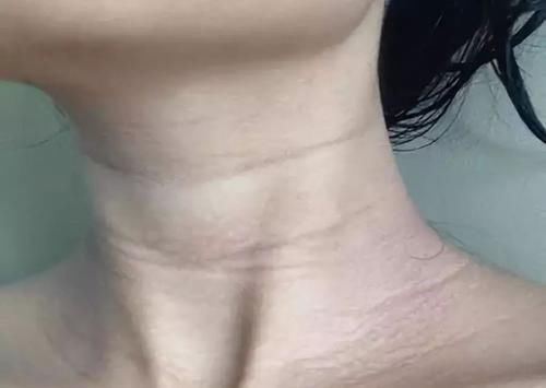  症状■肌肤变老有哪些症状?快来看看你的皮肤是否还年轻