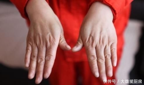 「留意」女人“提前变老”,多半和4个地方“挂钩”,大部分人都不会留意