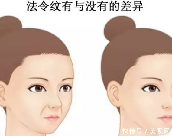 『法令纹出现』别让你的法令纹,泄露了你的年龄!