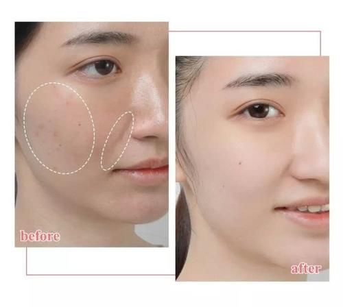 『深层清洁』脸上没有这3个问题的女生,皮肤好到遭人“嫉妒”,说的是你么?