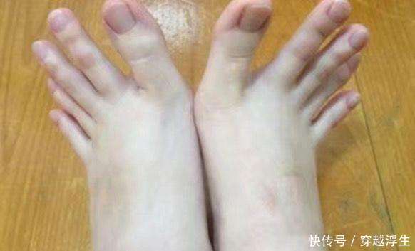 女子去美容店做按摩，脱下鞋后技师表示，按摩这么多年第一次遇到