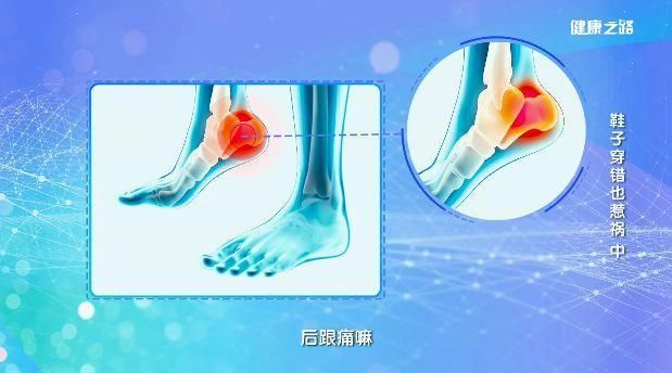 鞋子好不好，脚真的知道!买鞋前记住这3点!