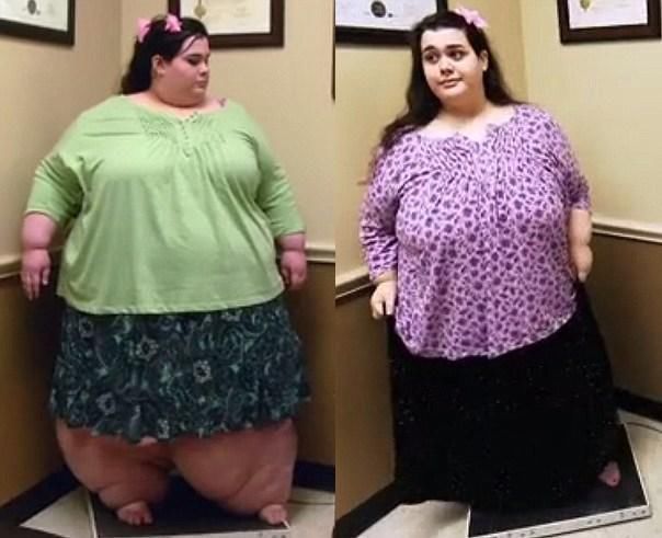 她从体重600斤到200斤，原来，肥胖会遮住一个人的美！