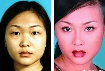 「好看」鼻子做成什么样才好看,一篇务实的鼻修复参考(三)|日本医美