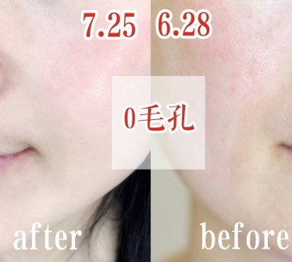 李小冉最爱的面膜，每天一片消灭暗黄肌，网友:30天真的有效!