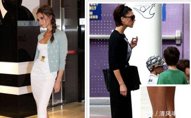 就算脚骨折都要穿恨天高的贝嫂, 居然独宠这双“丑凉鞋”三年!