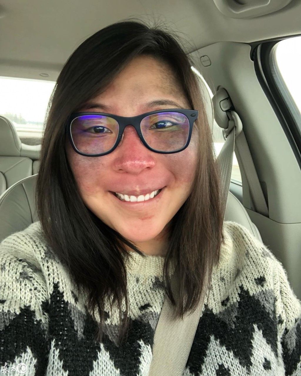 满脸胎记的美国妹纸化妆技术一流，却选择素颜出门，厉害了!