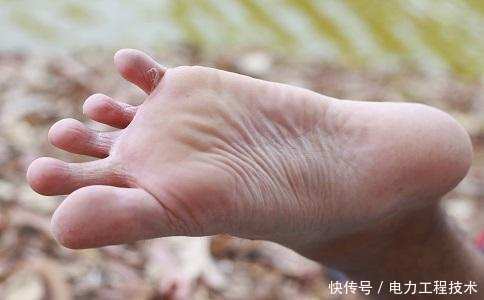 为什么老中医说脚臭的人身体好? 有什么依据吗