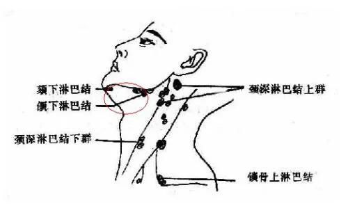 小孩颈部淋巴结肿大:是什么原因?如何治疗?医