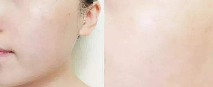 每天喝一点，皮肤就像吃了防腐剂，敷300张面膜可能都比不上...