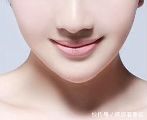 【消肿】自体脂肪丰下巴多久能消肿