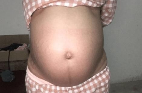  肚子■“你怀了假孕吧？肚子还没胸大”怀孕到底有多难熬？