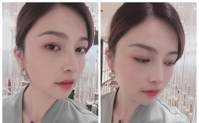  #术后#隆鼻真的有用吗？鼻综合术后六个月记录，这完全不是一个人！