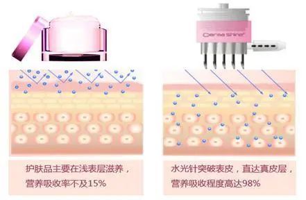 「皮下组织」热门医美项目“水光针”,真的有效果吗?