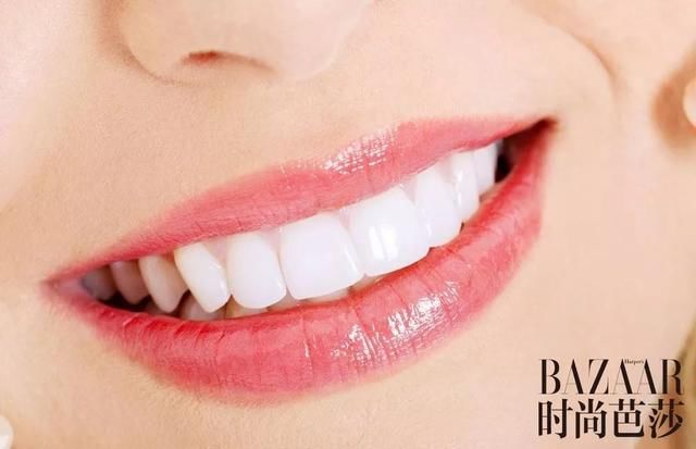 吴宣仪“牙龈笑”好甜！关于美牙你还得知道这些！