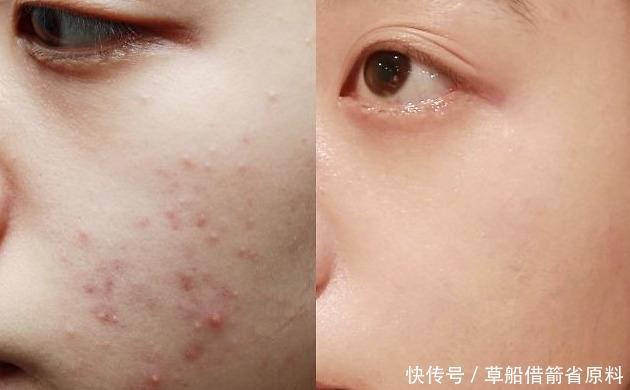 冤枉钱:细数你这些年花过的冤枉钱,护肤品行业的10个套路,小心毁脸