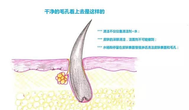  『导致皮肤』皮肤暗沉粗糙?毛孔粗大?那一定是你做错了这一步