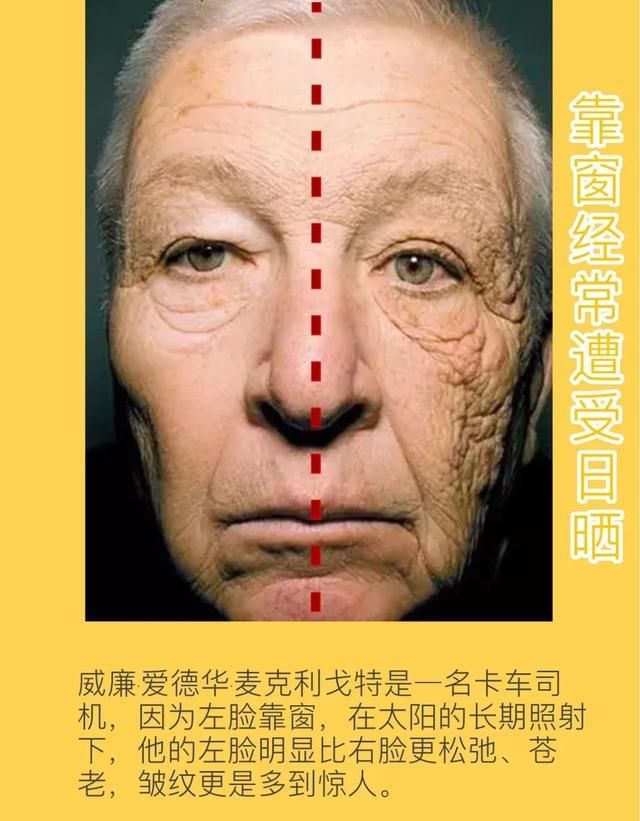  「黑色素」坚持美白三个月，一夜被打回原形，这样的错误你可能正在犯！