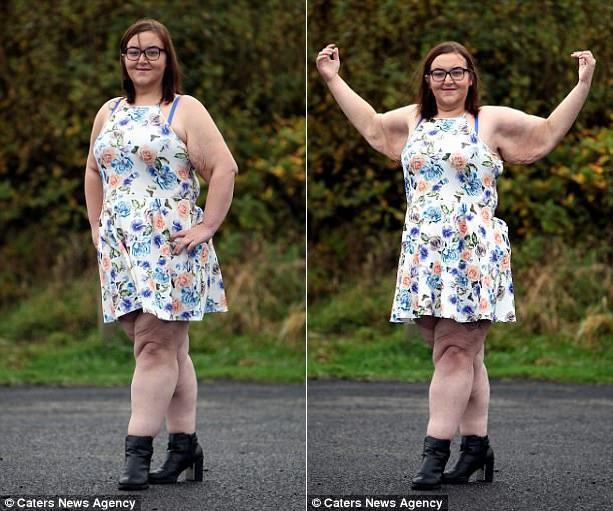 近400斤女子减去了一半体重，但还是开心不起来