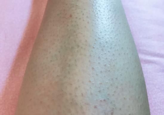 #图源小红书#身体磨皮大法 这样的肌肤谁不想摸?