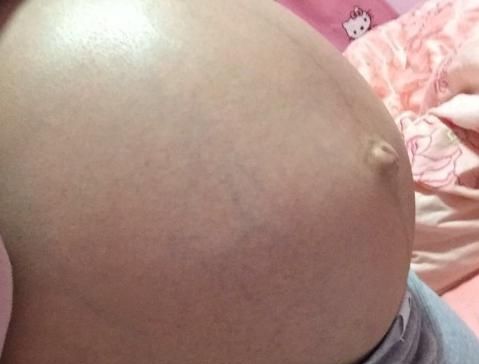  【不起】胎儿留级，很多孕妇还不知其因，这个锅胎儿背不起！
