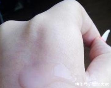 『眼霜』药店有二种“医用眼霜”,对付皱纹眼袋小菜一碟,遗憾是知道的人太少