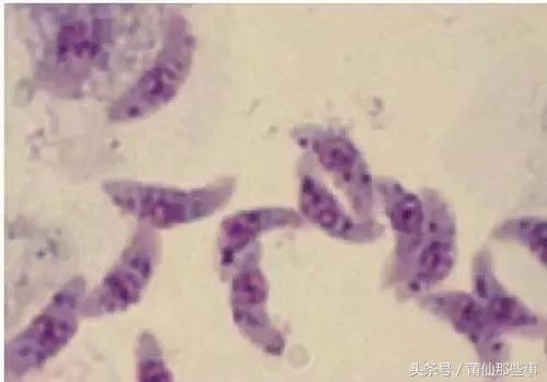 黄瓜中有杀不死的寄生虫，这条谣言你信了吗？挑选黄瓜请注意！