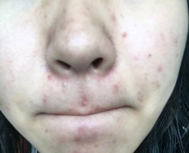  『女生』皮肤差的女生坚持这3点,皮肤会变好,特别第2点,颜值飙升!
