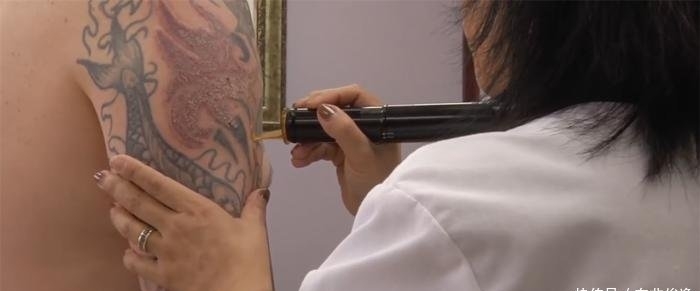 针头■纹身到底疼不疼用显微镜放大了100倍,看针头刺进皮肤有多疼