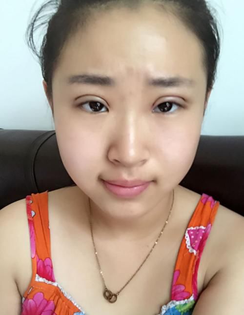 女生@被吓出一身冷汗,为何现在越来越少的女生割双眼皮?看到变化史后