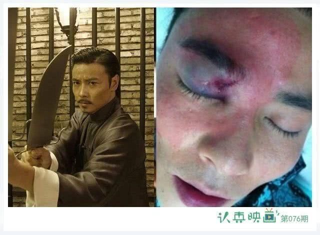 他们拒绝卖惨：葛优说拿那么多钱别喊辛苦 俞灏明请大家忘记大火