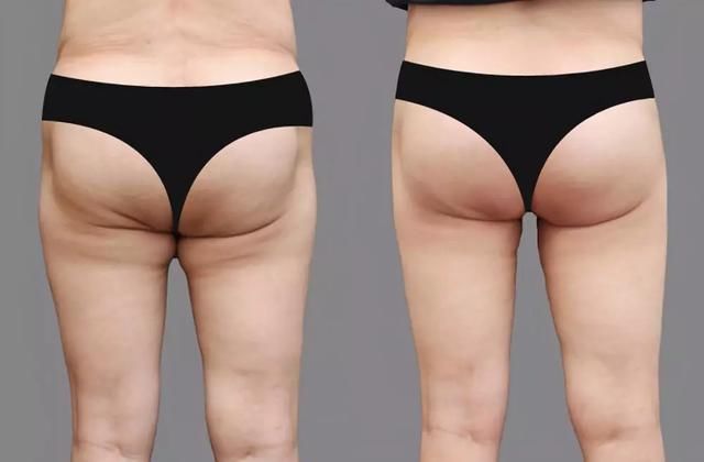 她一个屁股就够在北京买好几套房，比整容网红的脸都值钱!