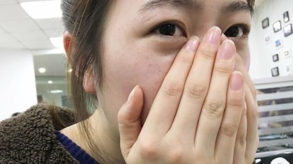  皮肤■鼻子上挤出白色颗粒到底是什么?教你3招,让毛孔更干净细腻