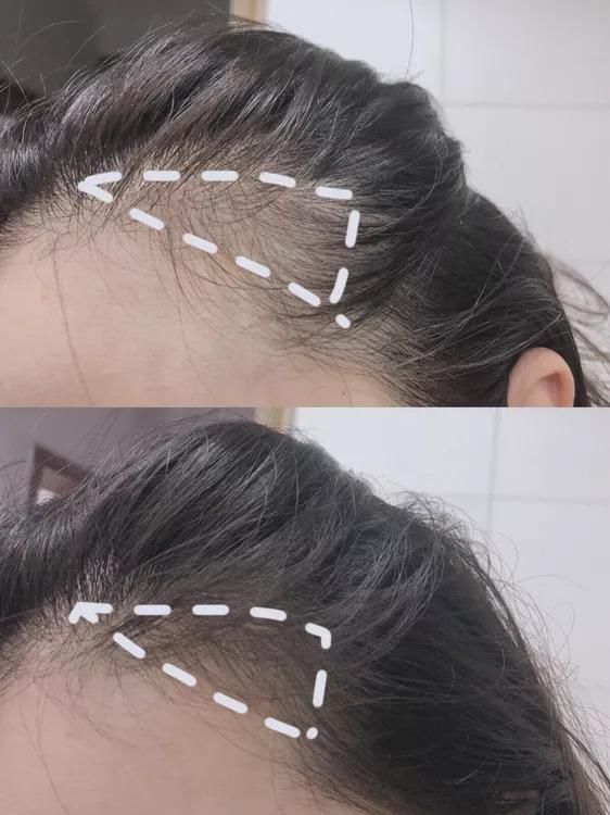 丸子头暴露发际线？4步修容大法拿好不谢！内附头发养护tips~