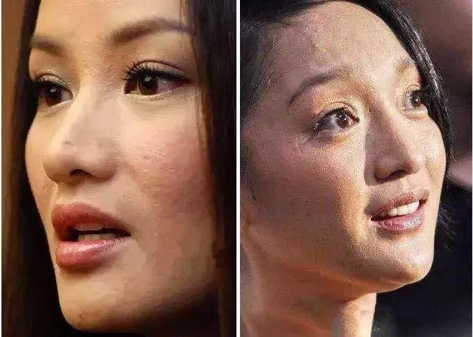 明星素颜哪家强?赵丽颖霍思燕黑头明显，林允真的没毛孔!