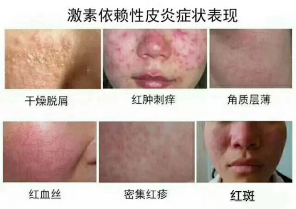 别再让这些护肤谣言毁了你的脸，第5条你肯定踩过坑!