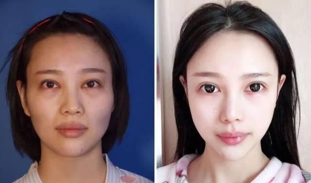  「看起来就」为什么做了整形也没有变好看