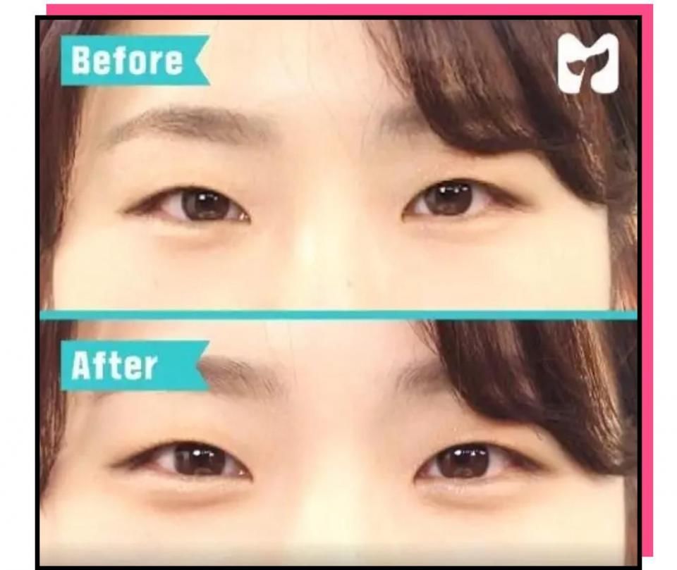 “你这个是肿眼泡，哭不出邓伦那样的双眼皮的。”