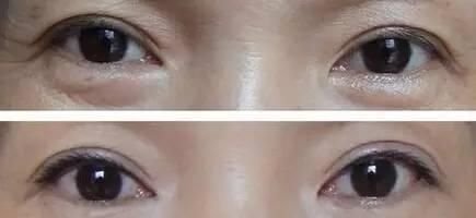 每天抹点它，活到五十没眼纹，没眼袋，神了！