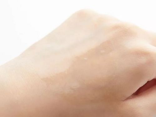 晒黑了?抹几天它，就能白回来