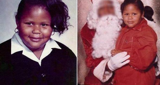 从600多斤到200多斤,减肥成功却留下一身赘皮,洗完澡都会发臭!