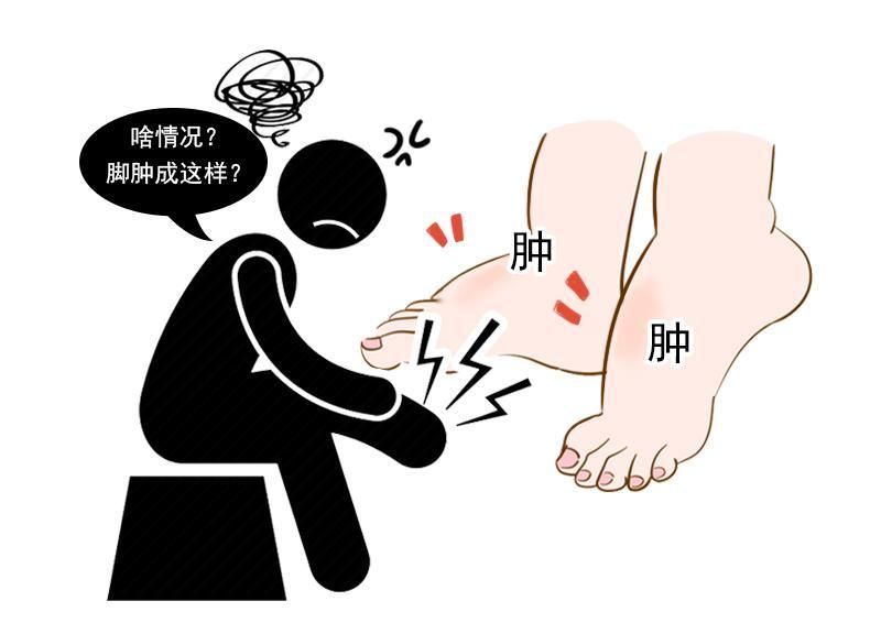  【症状】身体出现4个症状，说明尿酸已经失控，肾脏健康正岌岌可危